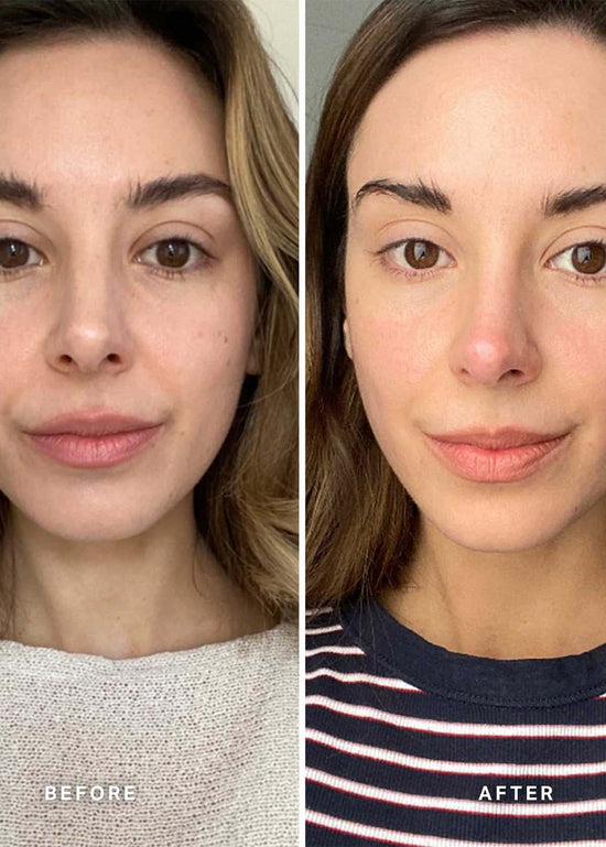 Serum Vitamin C